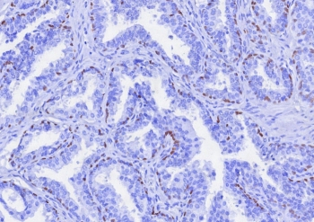 TP63 Antibody / Tumor protein 63 / p63