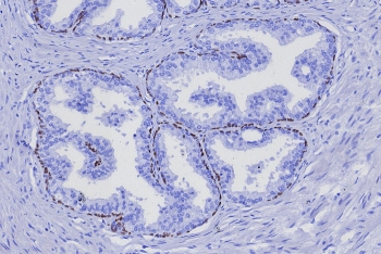 TP63 Antibody / Tumor protein 63 / p63