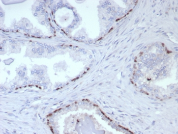 p63 Antibody / Tumor protein 63 / TP63