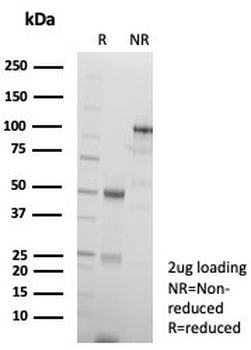 p63 Antibody / Tumor protein 63 / TP63