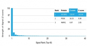 IGF2BP2 Antibody / IMP-2