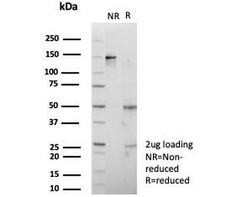 IGF2BP2 Antibody / IMP-2