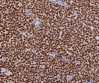 Recombinant FOXL2 Antibody / Forkhead box protein L2