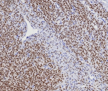 Recombinant FOXL2 Antibody / Forkhead box protein L2