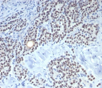 Recombinant FOXL2 Antibody / Forkhead box protein L2