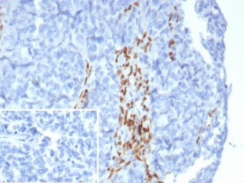 Forkhead box protein L2 Antibody / FOXL2