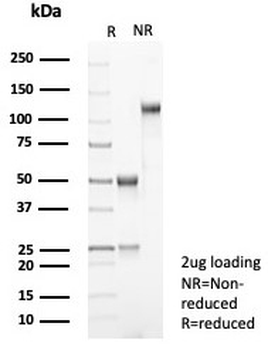 Beta Catenin Antibody / CTNNB1