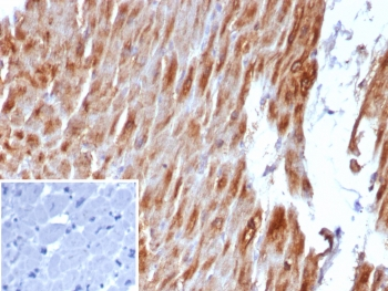 Desmin Antibody / DES