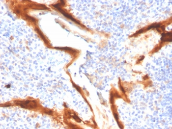 IL1RN Antibody / Interleukin-1 Receptor Antagonist / IL-1RA