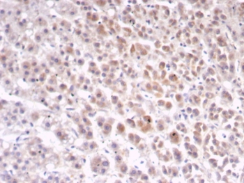 IL1RN Antibody / Interleukin-1 Receptor Antagonist / IL-1RA