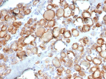 Thyroid Peroxidase Antibody / TPO