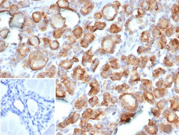 Thyroid Peroxidase Antibody / TPO