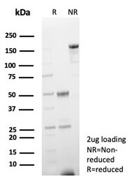 H-FABP Antibody / Heart Fatty Acid Binding Protein / FABP3
