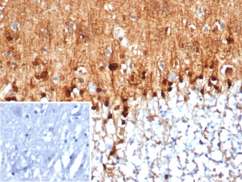 S100B Antibody