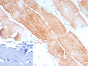 Sarcomeric Actinin Alpha 2 Antibody / ACTN2