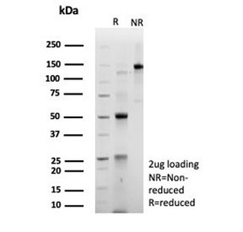 Sarcomeric Actinin Alpha 2 Antibody / ACTN2