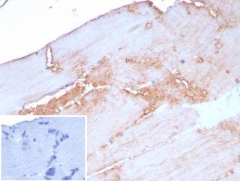 ACTN2 Antibody / Alpha Actinin 2 / Sarcomeric Alpha Actinin