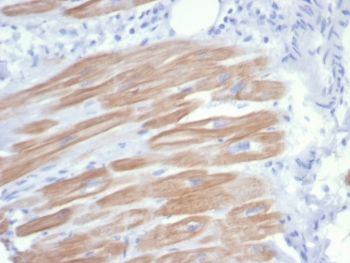 Recombinant ACTN2 Antibody / Alpha Actinin 2 / Sarcomeric Alpha Actinin