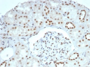 SMARCA4 Antibody / BRG1