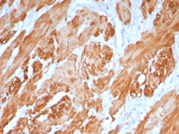 CNN1 Antibody / Calponin 1