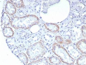 Recombinant CDH2 Antibody / Cadherin-2 / N-Cadherin