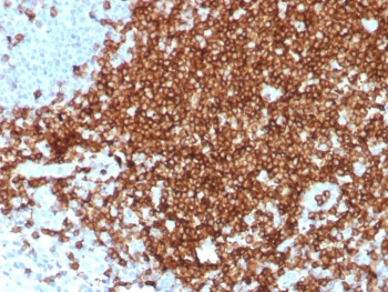 Recombinant CD7 Antibody
