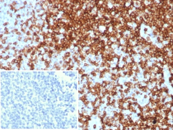 Recombinant CD7 Antibody