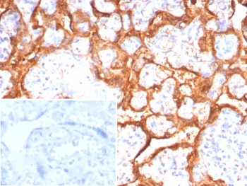Growth Hormone Antibody / GH1