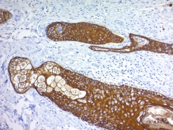 Pan Cytokeratin Antibody Cocktail (Acidic + Basic)