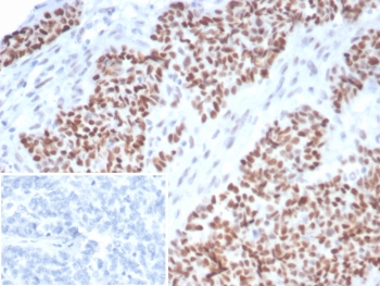 Recombinant p53 Antibody / TP53