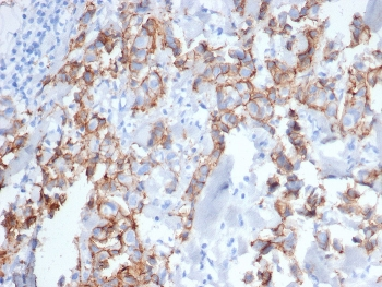 ErbB2 Antibody / HER2 / Extracellular region