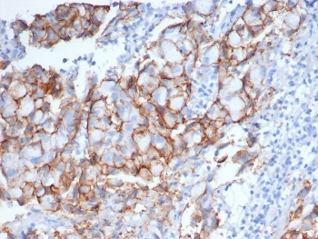 ErbB2 Antibody / HER2 / Extracellular region