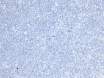 ErbB2 Antibody / HER2 / Extracellular region