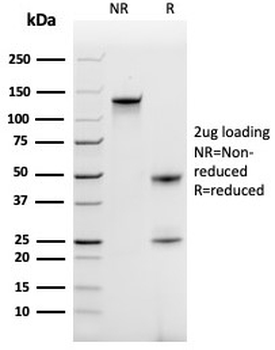CCL18 Antibody / PARC