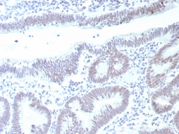 Recombinant TP53 Antibody / p53
