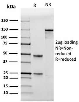 TP53 Antibody / p53