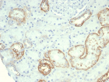 Recombinant CDH16 Antibody / Cadherin 16