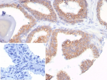 Recombinant CDH1 Antibody / E-Cadherin