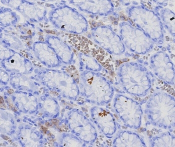 Recombinant BCMA Antibody / CD269 / TNFRSF17
