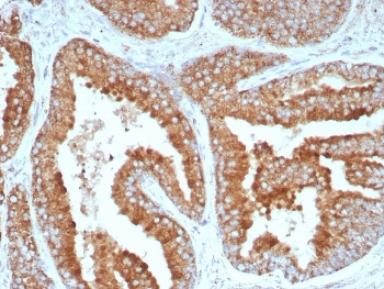 CD269 Antibody / BCMA / TNFRSF17