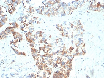 TNFRSF17 Antibody / BCMA / CD269