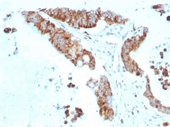 Recombinant CD269 Antibody / BCMA / TNFRSF17
