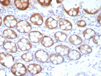 Recombinant Estrogen Inducible Protein pS2 Antibody / TFF1