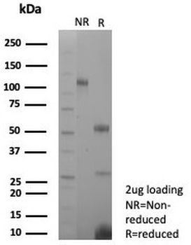 Recombinant Estrogen Inducible Protein pS2 Antibody / TFF1
