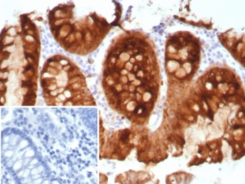 Recombinant Estrogen Inducible Protein pS2 Antibody / TFF1