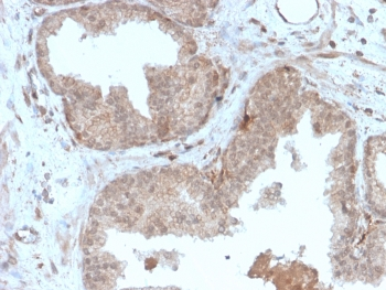 Recombinant MVP Antibody / Major Vault Protein