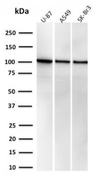 Recombinant MVP Antibody / Major Vault Protein