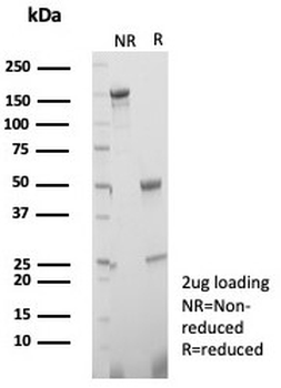 Estrogen Inducible Protein pS2 Antibody / TFF1