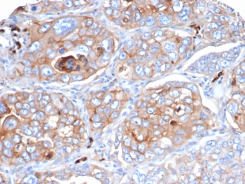 B7-H3 Antibody / CD276
