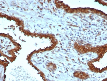 Galectin-3 Antibody / LGALS3